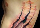 Inside-Under Skin